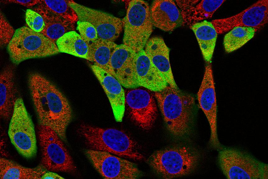 ASFV infected cells Cells infected with African swine fever